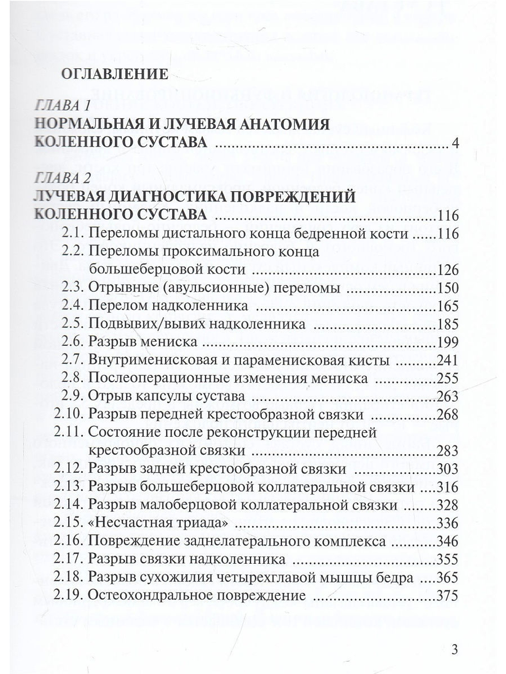 Лучевая диагностика повреждений коленного сустава