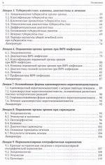 Эндогенные увеиты