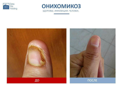Устройство "DeVita AP + " модель "Mini"