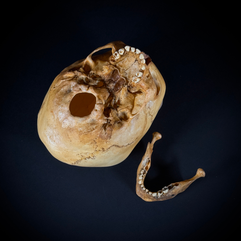 Череп человека ребёнок (анатомическая модель)