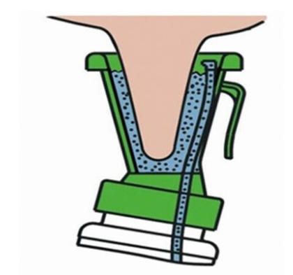Стакан для обработки вымени 300 мл
