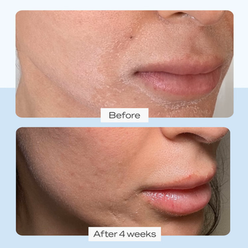 Восстанавливающий крем First Aid Beauty Ultra Repair Creme 170 г