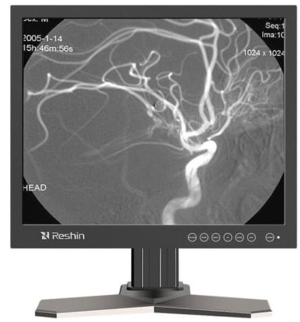Монитор 19" RESHIN MD17G