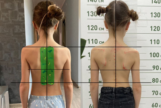 ДЕТИ: От 7 лет, коррекция таза, коррекция ног, коррекция стопы, коррекция шеи, коррекция внутренних органов