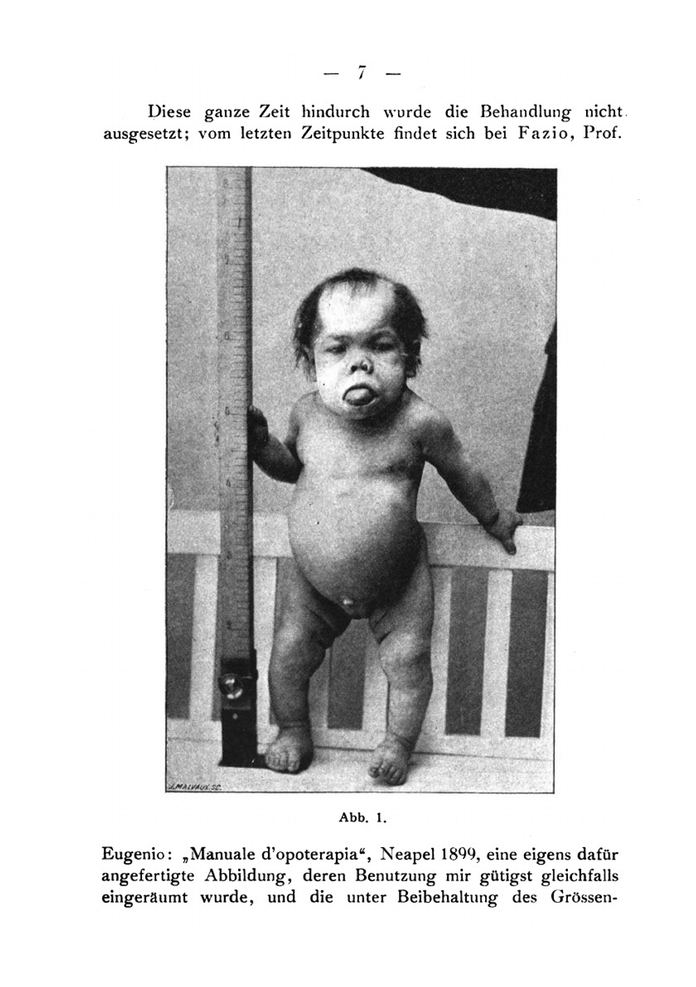 Die Rolle der Schilddrüse bei Stillstand und Hemmung des Wachstums und der Entwicklung | E. Hertoghe