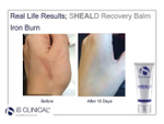 Is clinical SHEALD™ Recovery Balm 15 мл Бальзам защитный восстанавливающий -