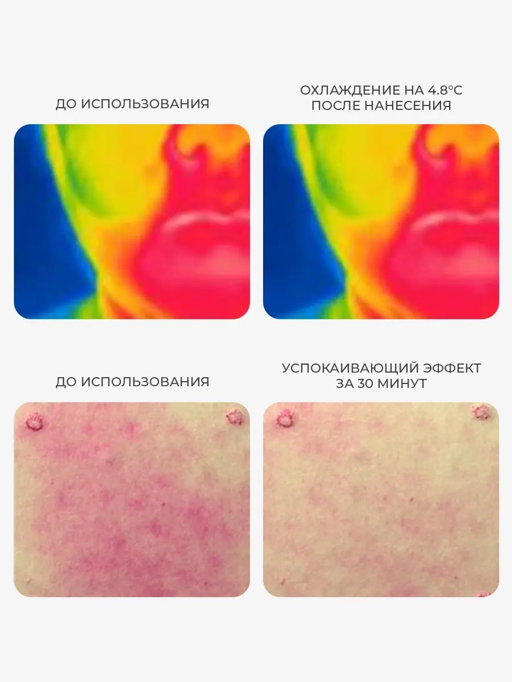 Arocell Успокаивающий крем-гель для чувствительной кожи - 5% пантенола Hyal B5 Soothing Cream 80 мл