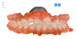 Интраоральный 3D сканер MaxFlex