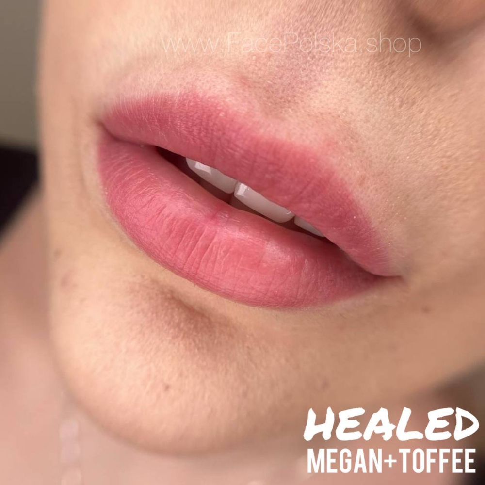 MEGAN