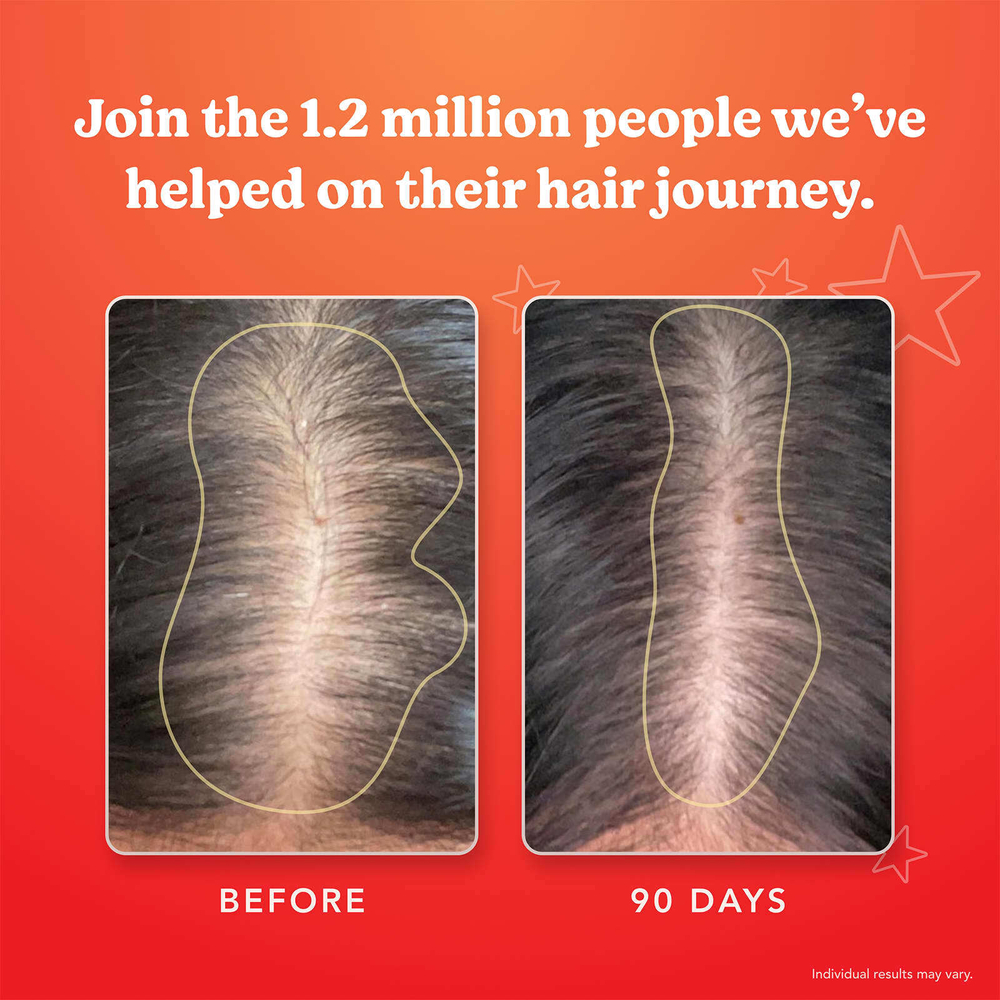 HAIRtamin, Advanced Formula, 30 веганских капсул