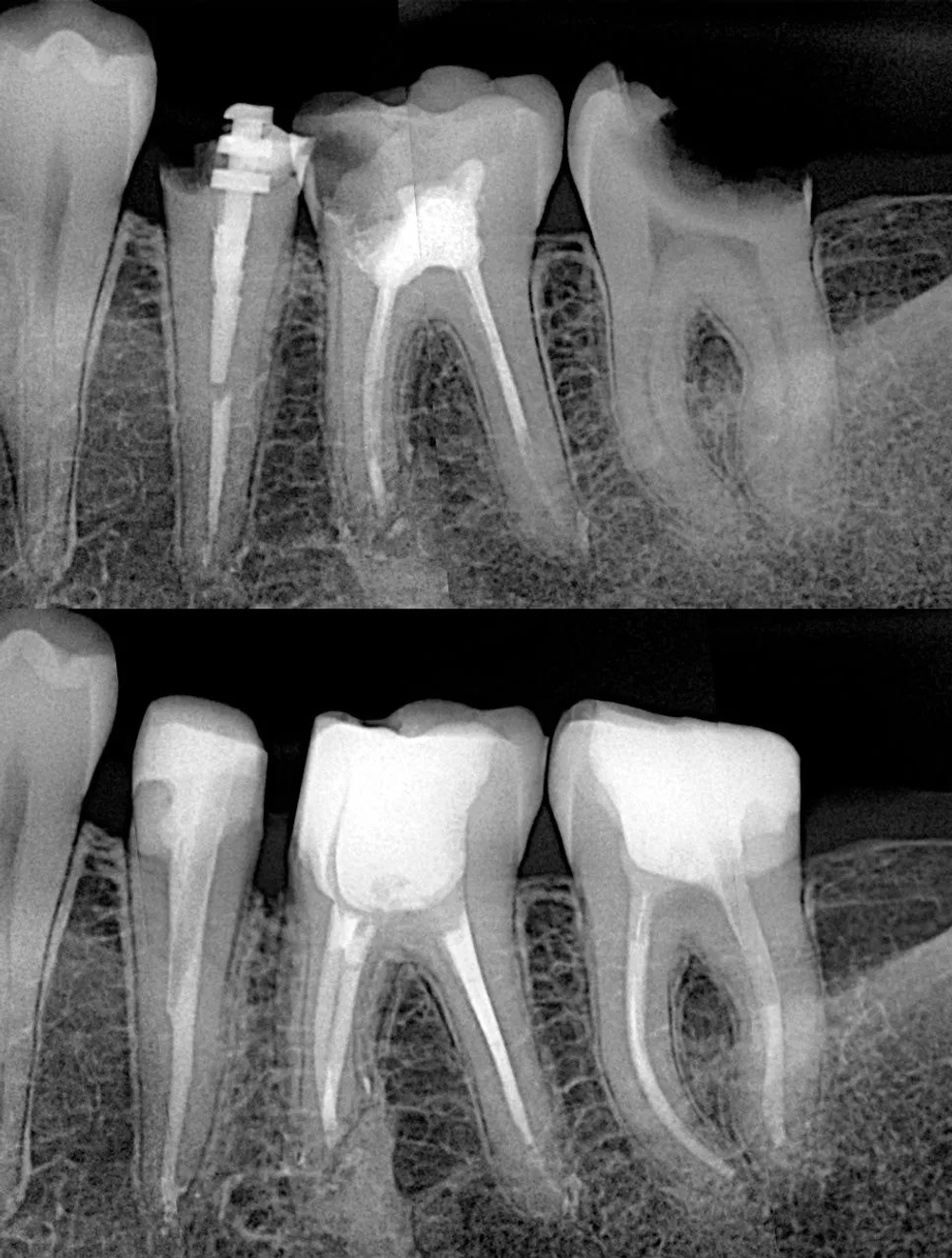 Радиовизиограф Eighteeth Nanopix 1