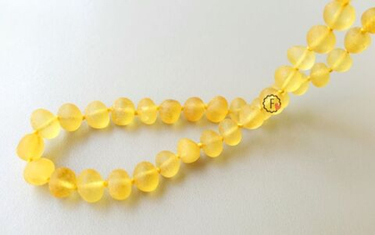 Бусы из янтаря с лечебным эффектом