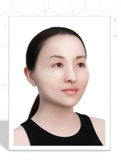 Патчи биорастворимые микроиглы с экзосомами| NEO:FUSION PRO EXO’NEEDLE PATCHES, Активная пропитка 15 мл| 100% гидрогель | Пептиды 400 ppm