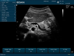 Аппарат УЗИ Edan DUS 60 (стандартный)