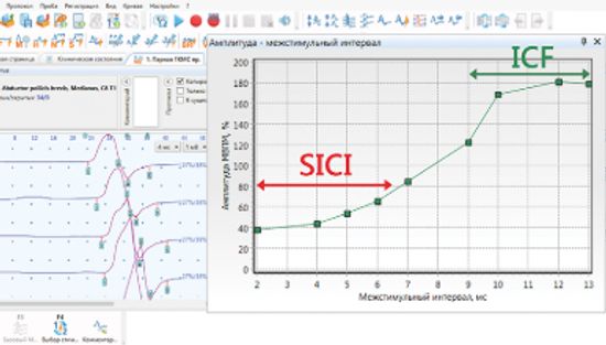 НЕЙРО-МС МОНОФАЗНЫЙ