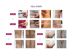Корректирующий липолитический термогель Anacis Vela Shape Resculpting Thermo Gel Vela Shape Active Body Systeme