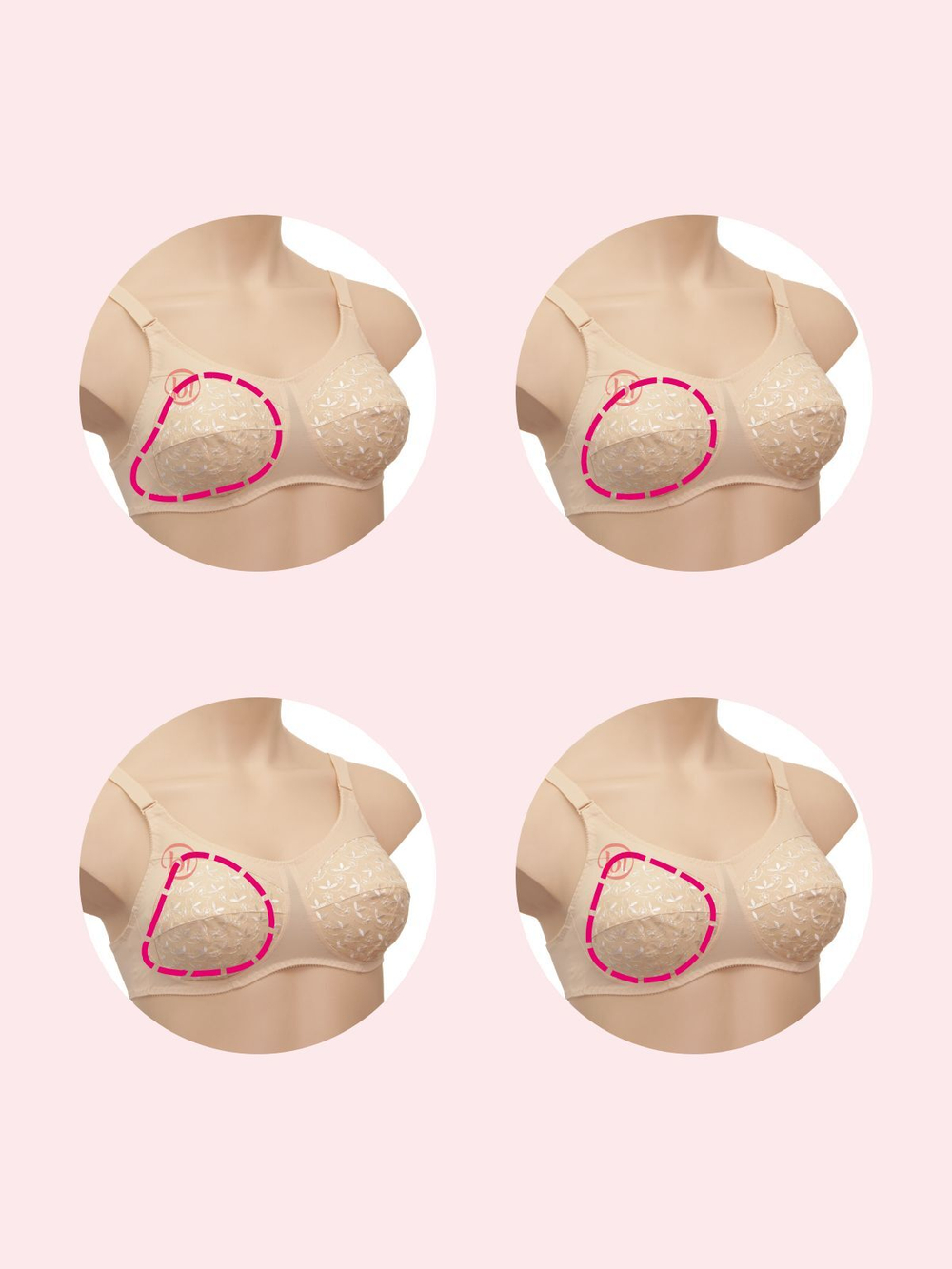 Бюстгальтер для фиксации экзопротеза молочной железы Valeria арт. 0091/0939, цвет бежевый, р. 75D