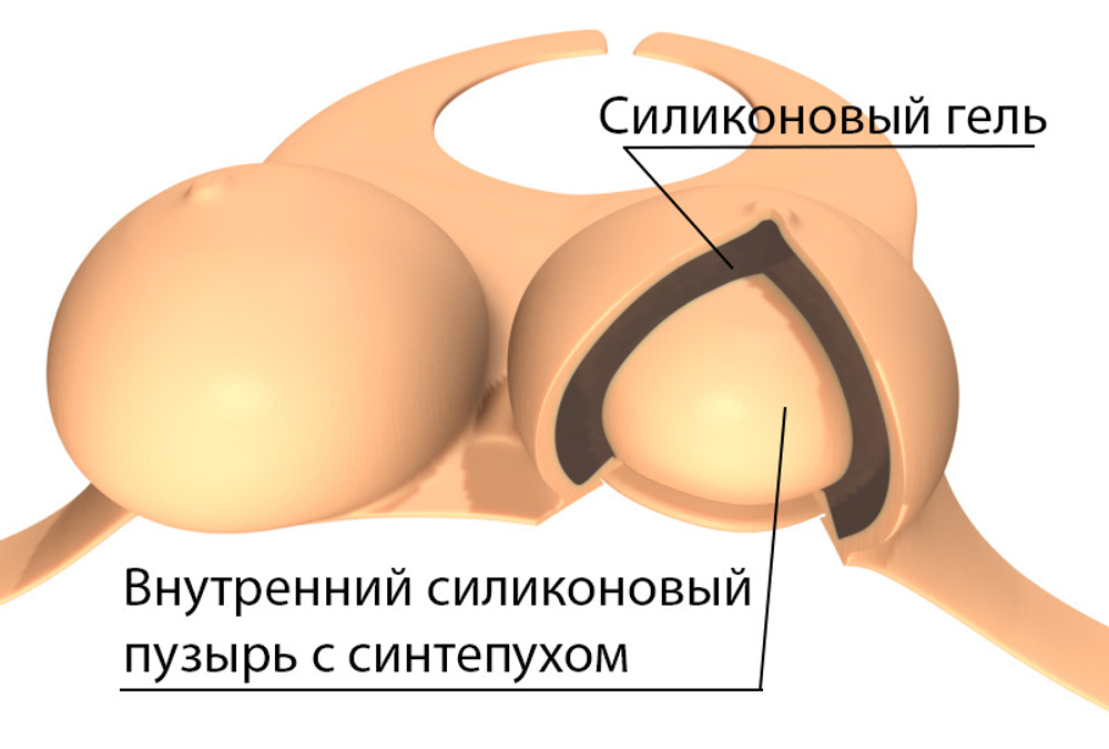 Силиконовая накладная грудь, Размер F (5Й) на обхват 90-110 см с застежками на шее и за спиной