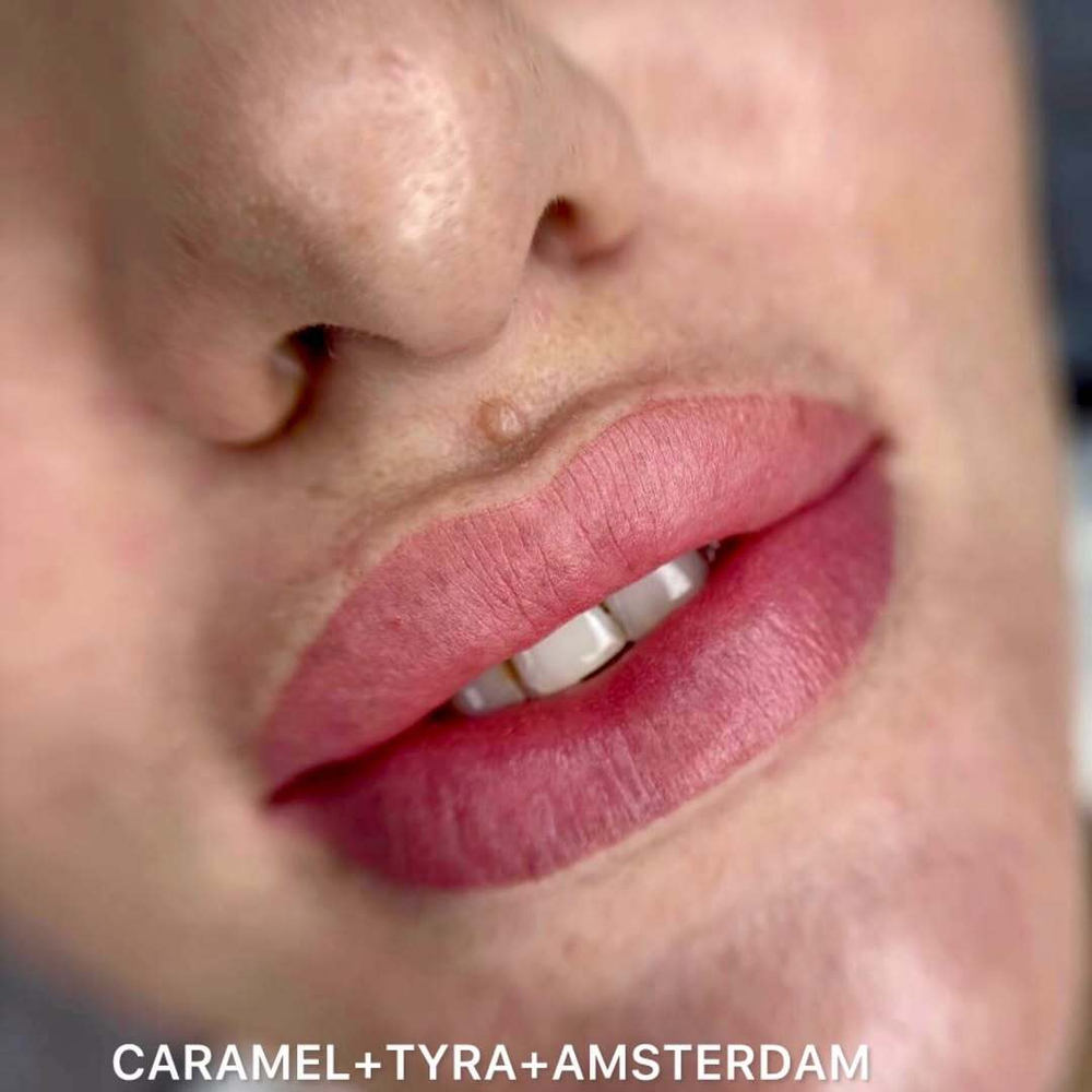 AMSTERDAM