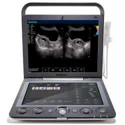 Аппарат УЗИ (сканер) Sonoscape S9 Vet