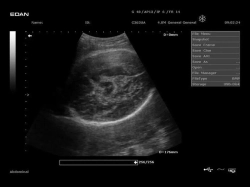 Аппарат УЗИ Edan DUS 60 (для гинекологии, стандартный)