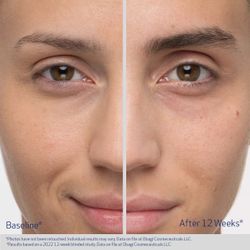 Obagi Medical Сыворотка бустер для роста бровей NU-CIL Eyebrow Boosting Serum 5 мл