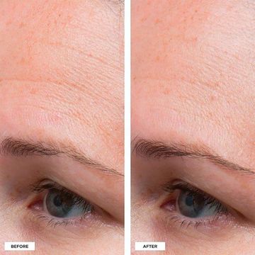 Увлажняющий крем Perricone MD High Potency Classics: Hyaluronic Intensive Moisturizer