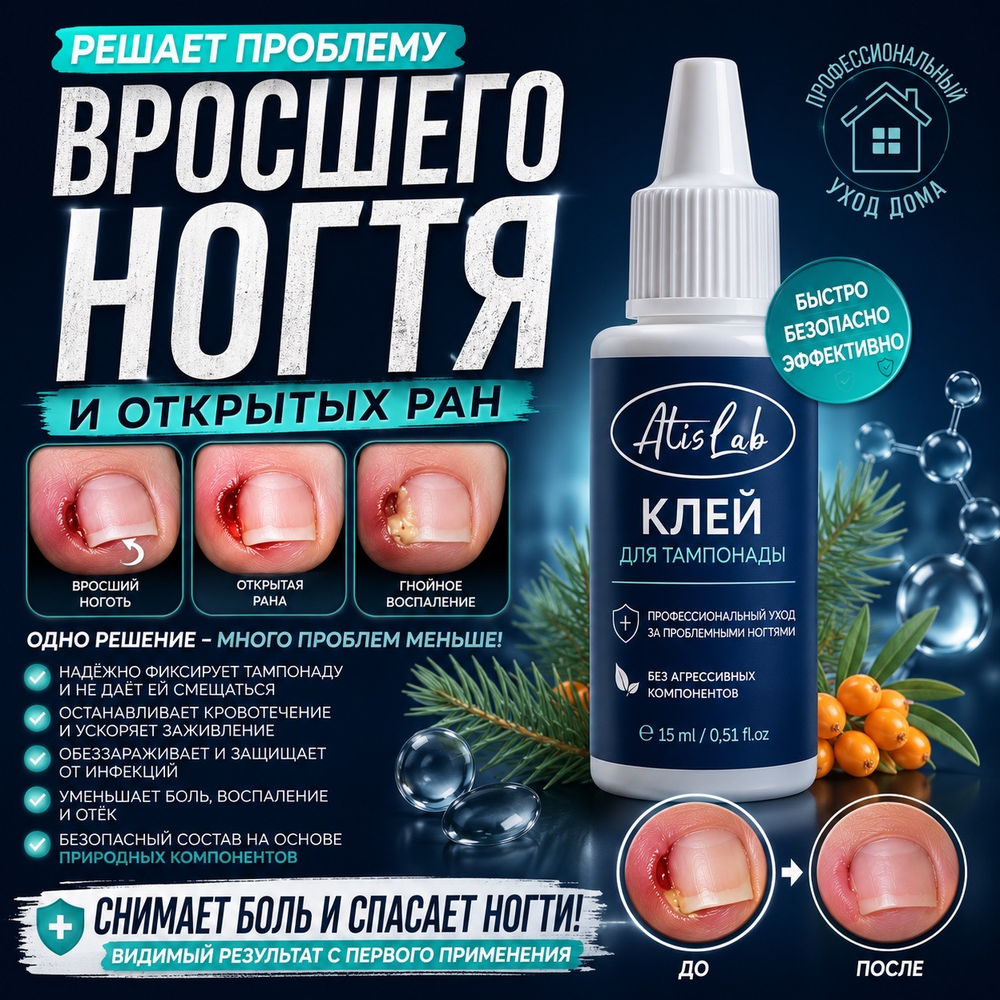 Клей для тампонады и открытых ран.
