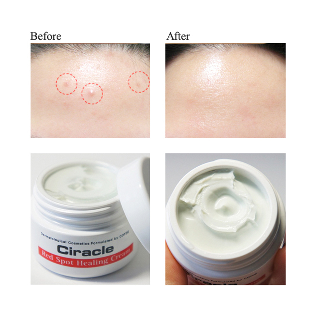 Крем локальный для проблемной кожи Ciracle Red Spot Cream 30гр