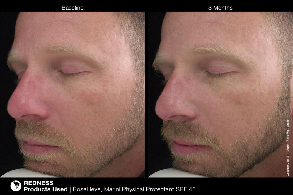 JAN MARINI PHYSICAL PROTECTANT SPF45 (TINTED) Солнцезащитный крем с тональным эффектом с SPF 45