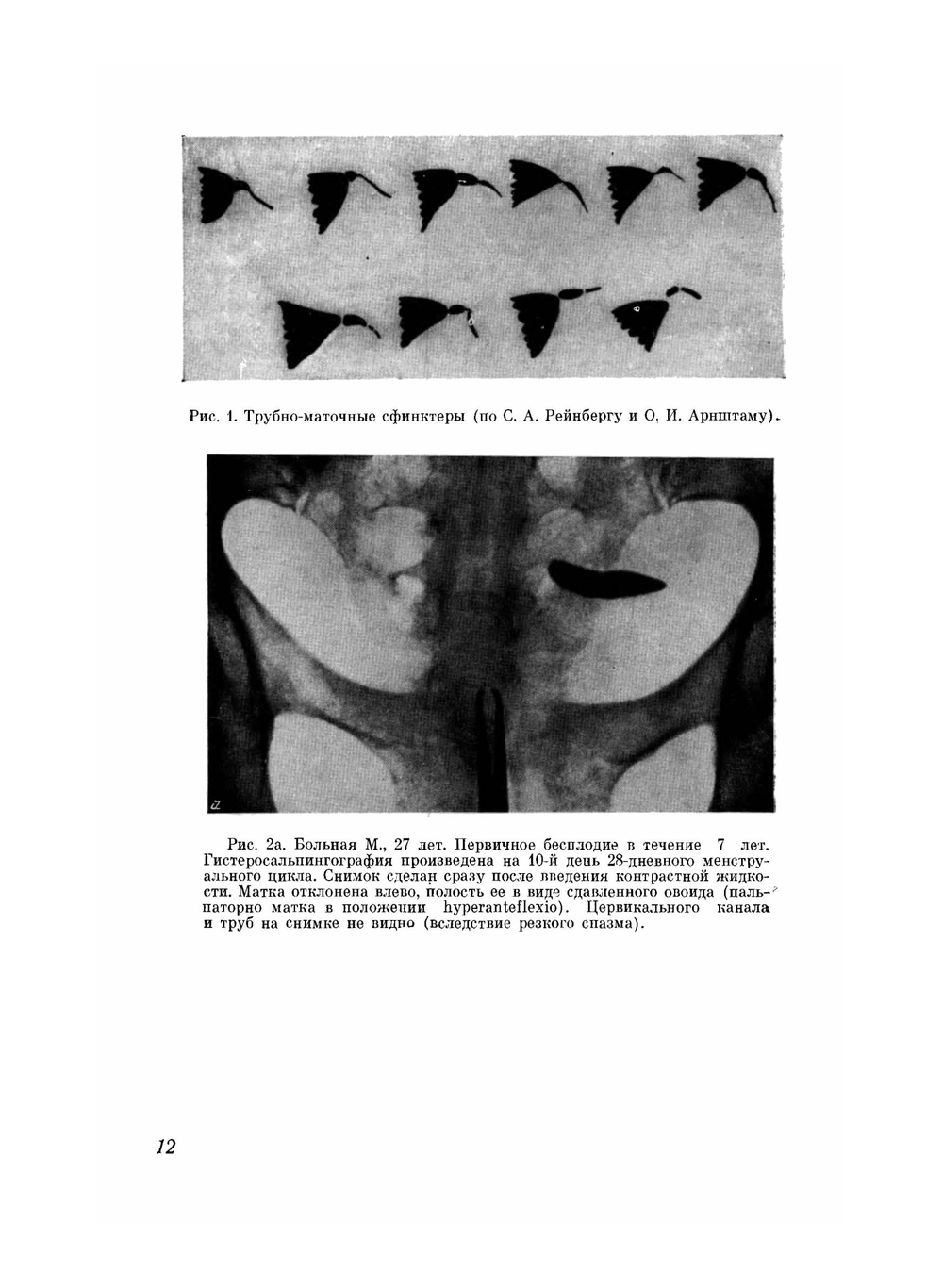 Атлас гистеросальпингографии | М.М. Абрамова