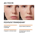 Всесезонный пилинг с 25% миндальной кислоты ICON SKIN 25 % Mandelic Smart Peel System, 30ml