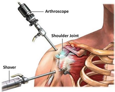 Артроскопические операции Регенеративная медицина Ортопедическая хирургия