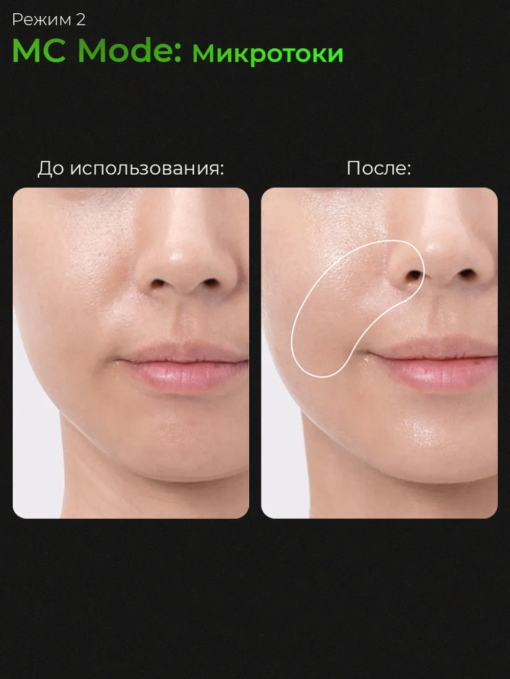 Medicube Микротоковый аппарат для лица 6-в-1 AGE-R Booster Pro Black