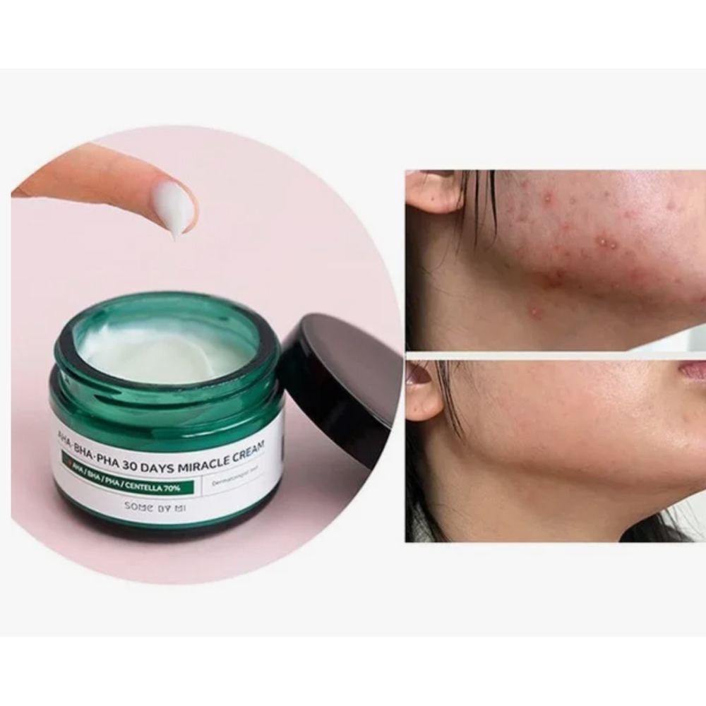 Восстанавливающий крем для проблемной кожи Some By Mi AHA-BHA-PHA 30 Days Miracle Cream 60 г.