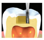 Бор твердосплавный Midwest - 201 FG 558