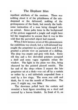 The Elephant Man and Other Reminiscences | F. Treves