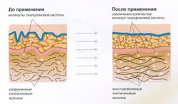 Коллаген говяжий (MegaProtein ST)