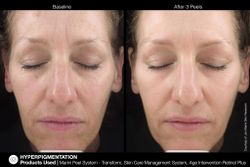 JAN MARINI AGE INTERVENTION RETINOL+ 0,5% Крем-акселератор с ретинолом 0,5% для борьбы с видимыми возрастными изменениями