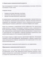 Венозные синусы черепа - один из ключей к мигреням