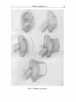 Руководство по оториноларингологии. Болезни уха | А.Г. Лихачев