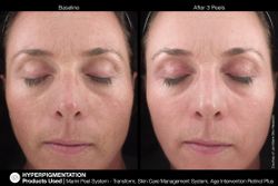 JAN MARINI AGE INTERVENTION RETINOL+ 0,5% Крем-акселератор с ретинолом 0,5% для борьбы с видимыми возрастными изменениями