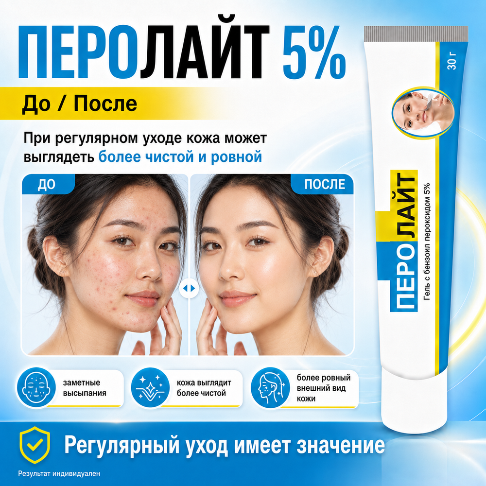 ПЕРОЛАЙТ  5% гелі