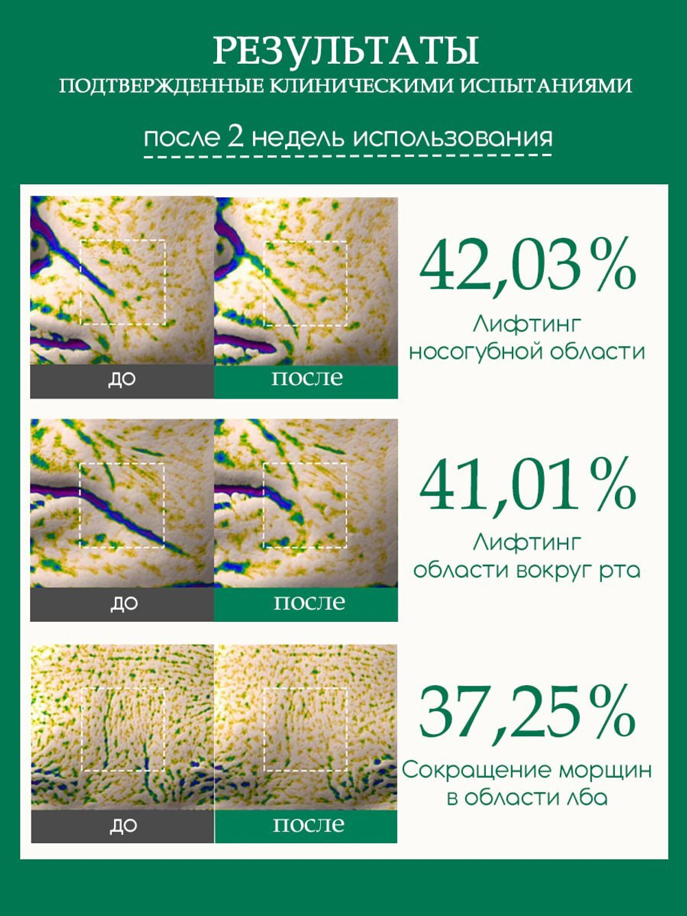 Ампульная сыворотка Collagen Sil Booster Ampoule, лифтинг-ампула + 4 ампулы «коллагеновая нить»