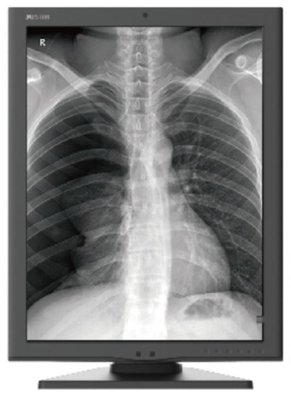 Монитор 21,3" Jusha JUSHA-M260G