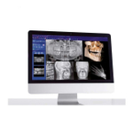 Стоматологический томограф с цефалостатом Castellini X-Radius Trio Plus