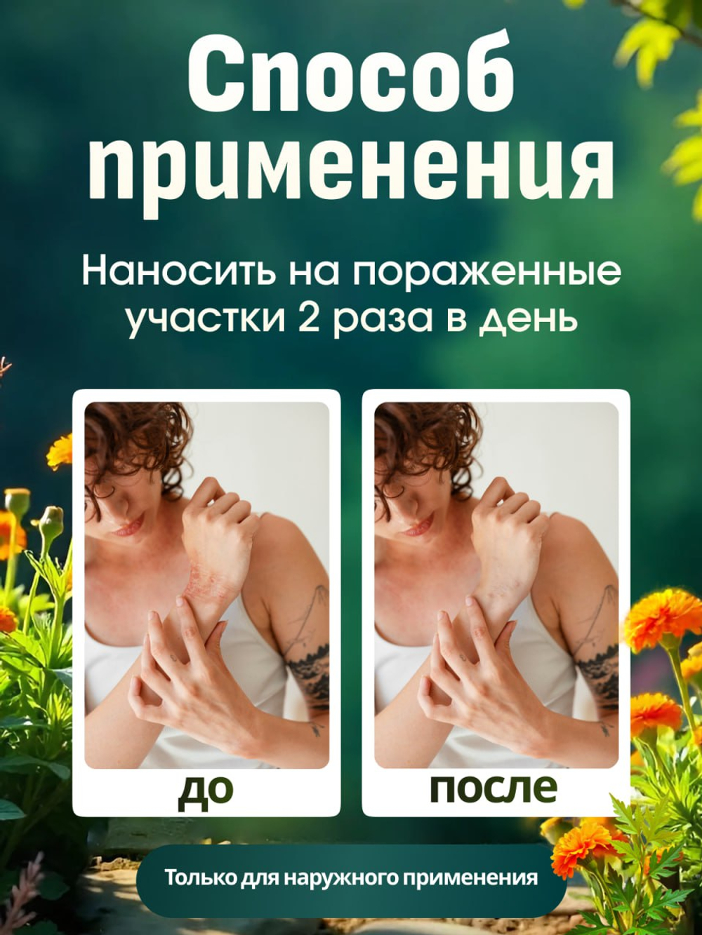 ГОМЕОПАТИЧЕСКИЙ БАЛЬЗАМ УРТИКА 25 г