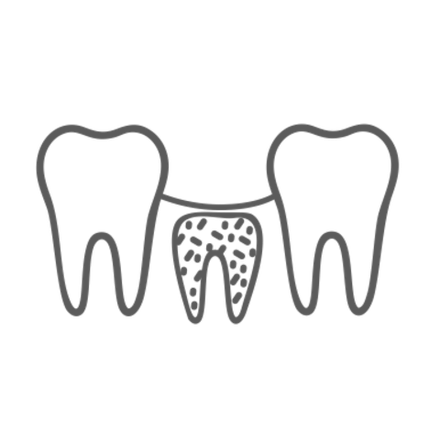 РЕШЕНИЯ ДЛЯ КОСТНОЙ ПЛАСТИКИ