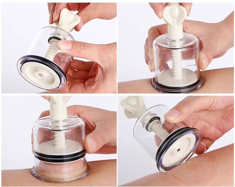 Вакуумные массажные банки с вентилем 8 штук