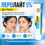 ПЕРОЛАЙТ  5% гелі